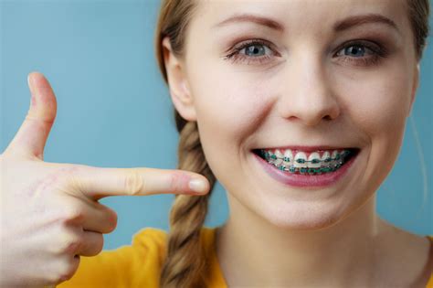 braces with metal brackets and|pictures of traditional steel braces.